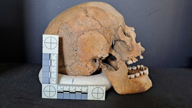 A skull seen from the side with a ruler next to it 
