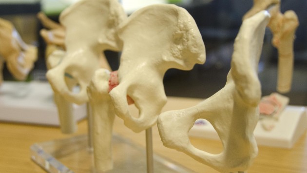 Hip bone models on display