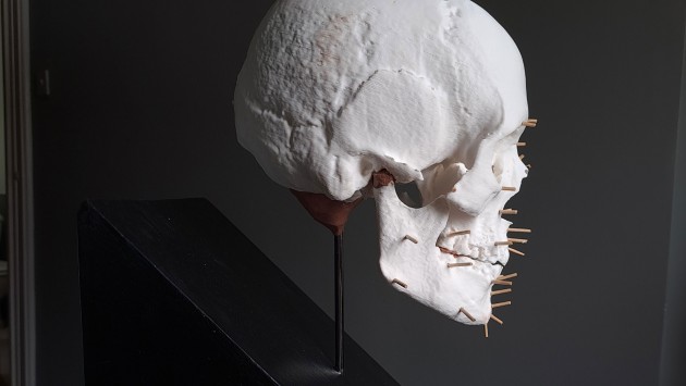The 3D printed replica of Kimmeridge Woman's skull