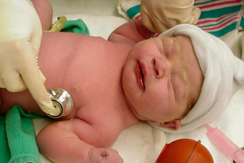 A doctor putting a stethoscope to a newborn baby's chest 