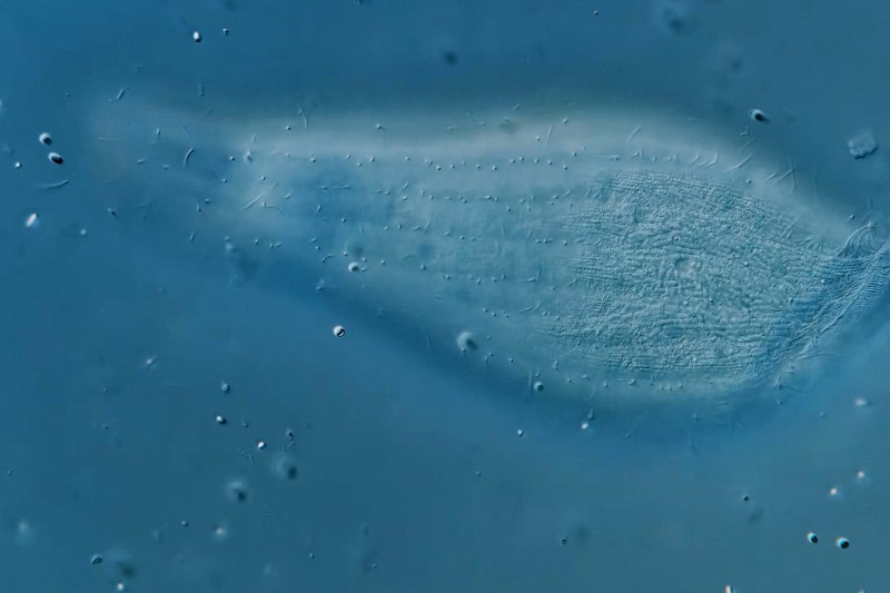 A image of a tube-shaped microorganism which is wider at one side and narrow at the other. The wider side has what looks like an open whole or mouth at the end