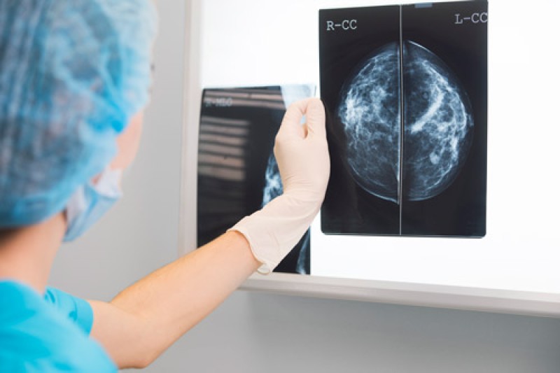 Woman In Surgery Outfit Is Holding A Mammogram In Front Of Xray Illuminator