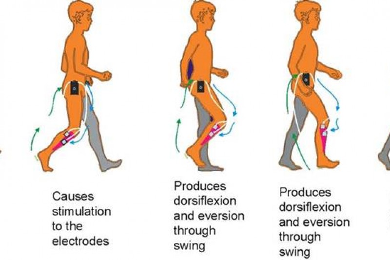 Function Electrical Stimulation (FES) in neurological rehabilitation