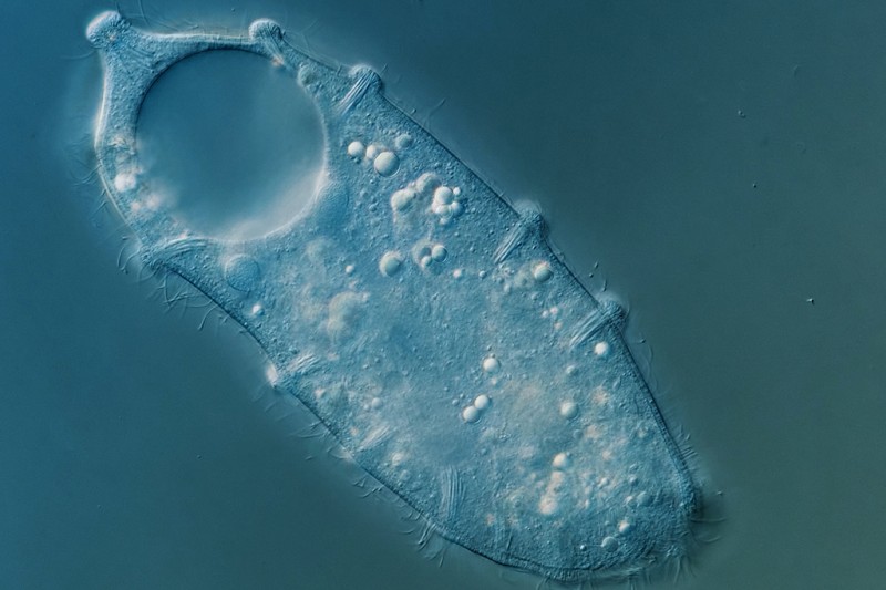 Lacerus An image of an oblong shaped, single cell organism with a circle on the end of it and white spots across it