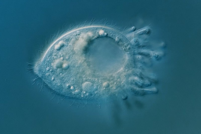 An image of an oblong shaped, single cell organism with a circle in the middle of it and trailing tentacles