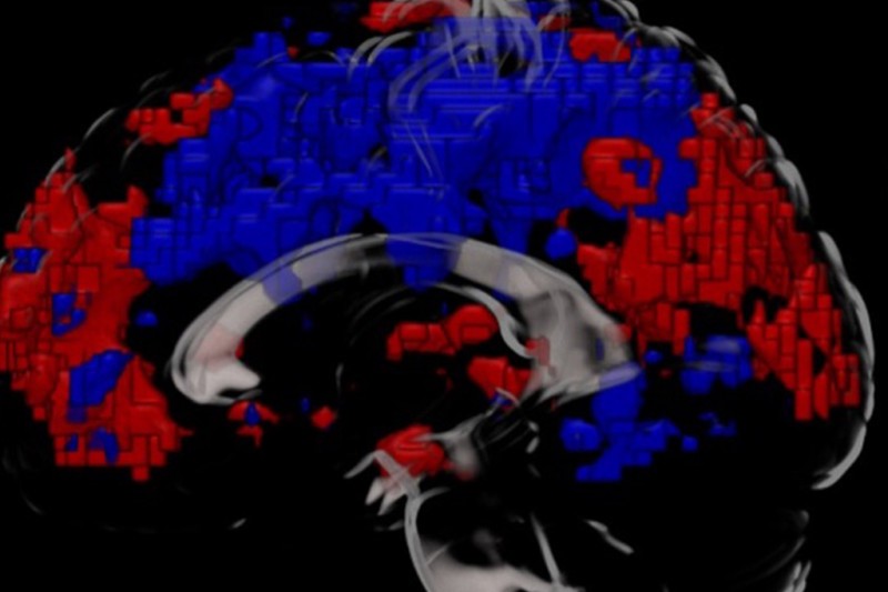 an MRI Scan of a human brain - the front and rear show red, the middle shows blue. 