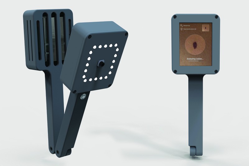 SK Insight handheld device shown from the front and back. One side has a circles of small light bulbs, the other is a display screen saying "Analysing lesion"