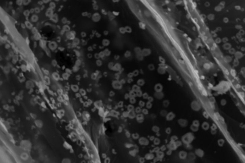 A black and white image from the microscope. Hundreds of small rings are shown within the fibres of a loofah