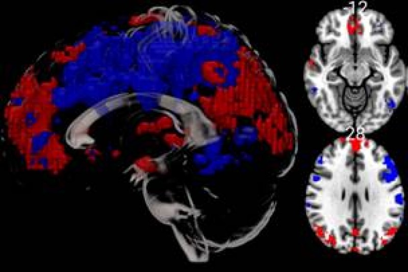 cold water MRI brain scans