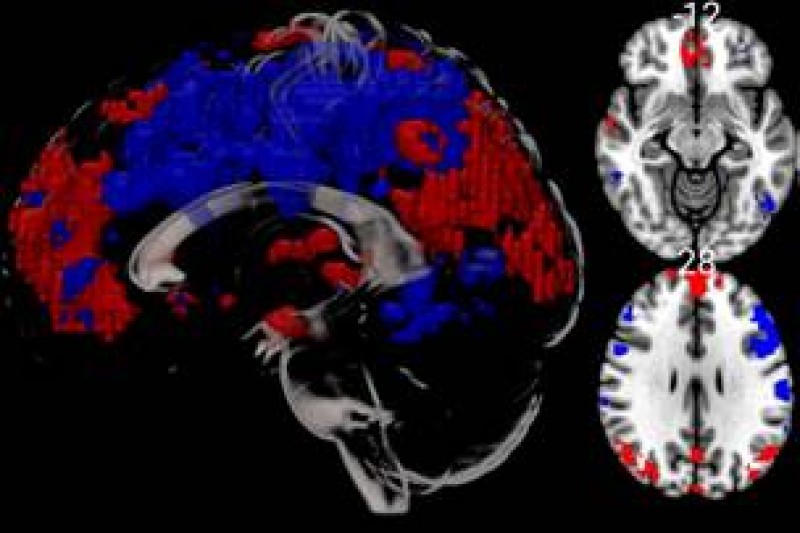 cold water MRI brain scans 