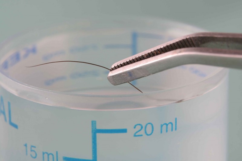 forensic hair analysis forensic hair analysis