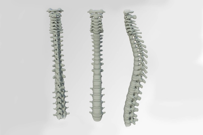 A selection of spines Three spinal columns in a line